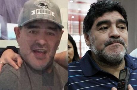 maradona before after